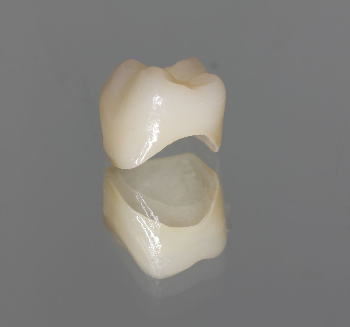 Single zirconian crown with porcelain