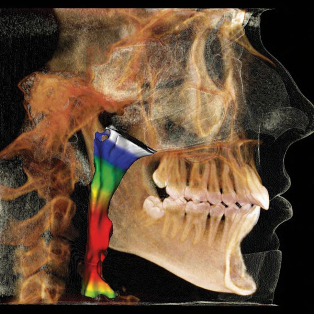 Airway & Sleep Dentistry