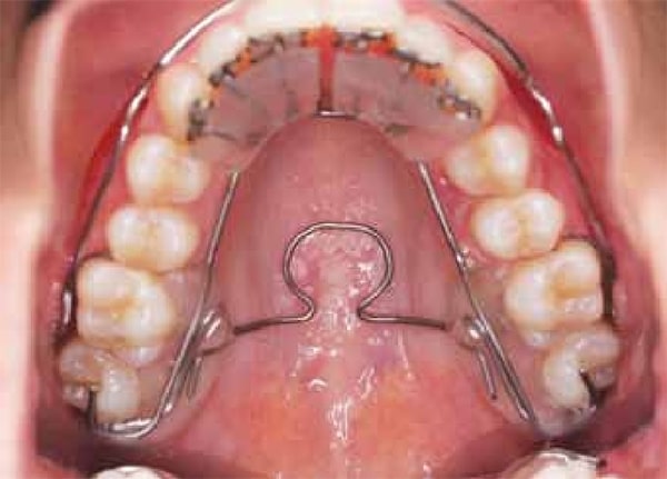 Epigenetic Dentistry